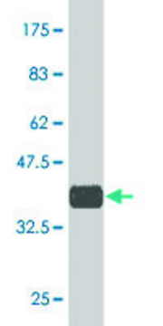 Monoclonal Anti-ZNF265, (N-terminal) antibody produced