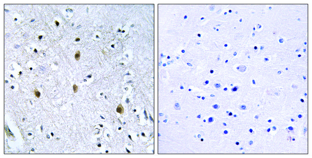 Anti-IRS-1 antibody produced in rabbit