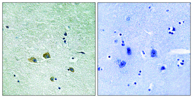 Anti-PAK1 antibody produced in rabbit
