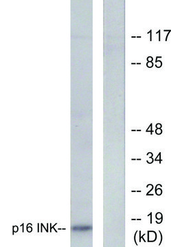 Anti-p16 INK antibody produced in