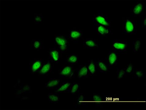 ANTI-SURB7 antibody produced in mouse
