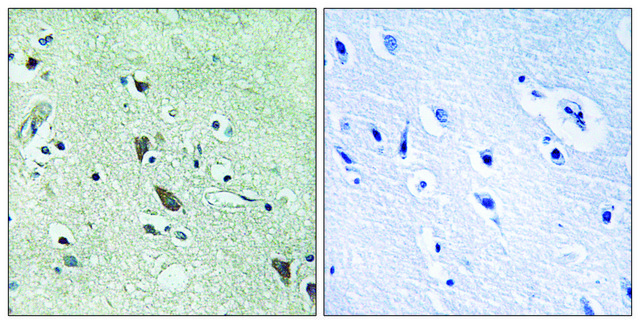 Anti-HTRA2 antibody produced in rabbit