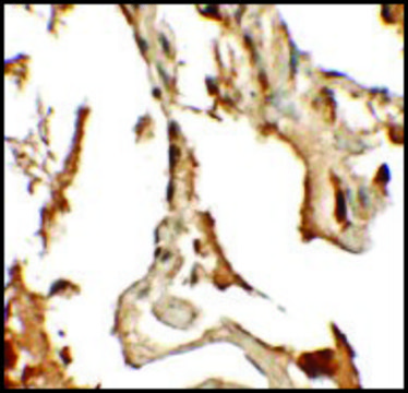 Anti-RILPL2 antibody produced in rabbit