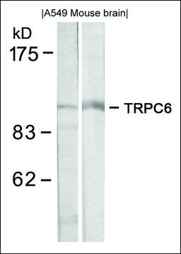 Anti-TRPC6 antibody produced in rabbit