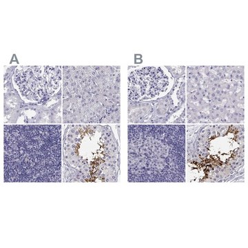 Anti-CABS1 antibody produced in rabbit