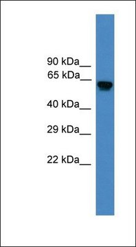 Anti-USP17L2 antibody produced in rabbit