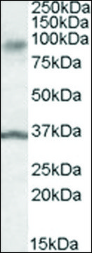 Anti-ANKK1 antibody produced in goat