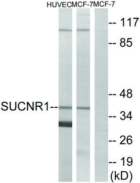 Anti-SUCNR1 antibody produced in rabbit