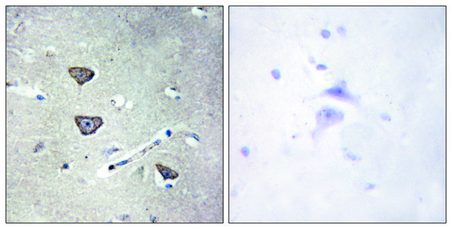 Anti-5-HT-2C antibody produced in rabbit