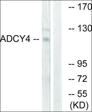 Anti-ADCY4 antibody produced in rabbit