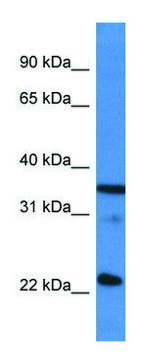 Anti-SFRS2 (C-terminal) antibody produced in
