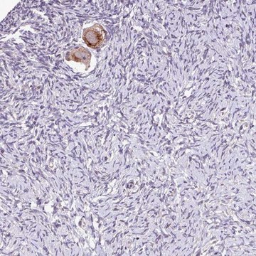 Anti-TTLL3 antibody produced in rabbit