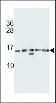 ANTI-HIST1H2AB(N-TERMINAL) antibody produced in rabbit