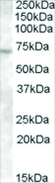 Anti-ABCE1/ RNase L Inhibitor antibody