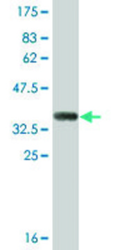 Monoclonal Anti-SULT1B1, (N-terminal) antibody produced