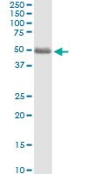 Anti-ST3GAL2 antibody produced in rabbit