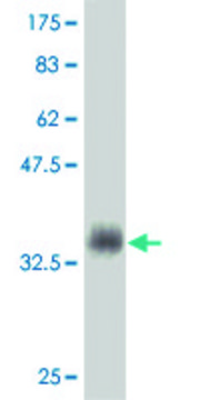 Monoclonal Anti-MSMB antibody produced in