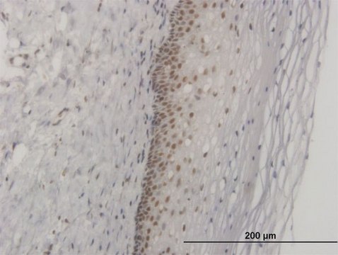 ANTI-FOXL1 antibody produced in mouse