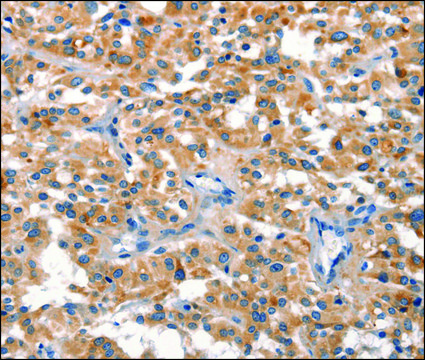 Anti-DUSP2 antibody produced in rabbit