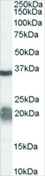 Anti-Arginase, Type 1/ARG1 (AB1) antibody
