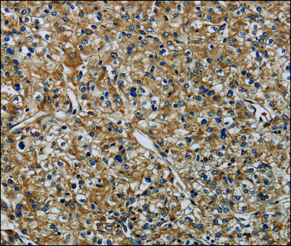 Anti-HSPG2 antibody produced in rabbit