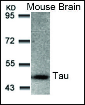 Anti-MAPT (Ab-205) antibody produced in