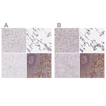 Anti-PYCARD antibody produced in rabbit