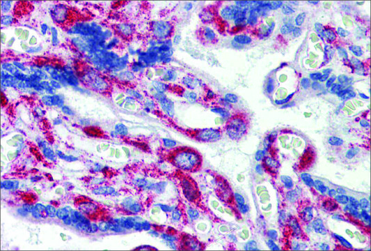Anti-GPR6 antibody produced in rabbit