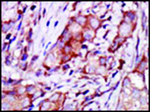 Anti-KIP2 (N-term) antibody produced in