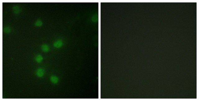 Anti-Telomerase antibody produced in rabbit