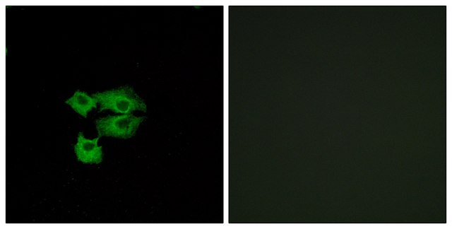 Anti-LY6E antibody produced in rabbit