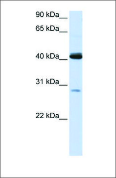 Anti-GCDH antibody produced in rabbit