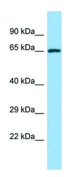 Anti-YTHDF2 (C-terminal) antibody produced in
