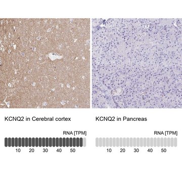 Anti-KCNQ2 antibody produced in rabbit