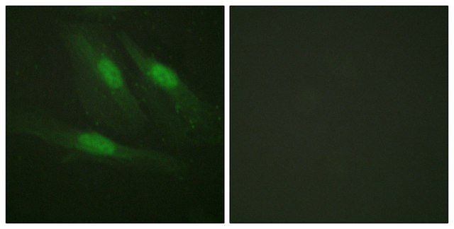 Anti-Catenin-? antibody produced in rabbit