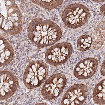 Anti-UQCC3 antibody produced in rabbit