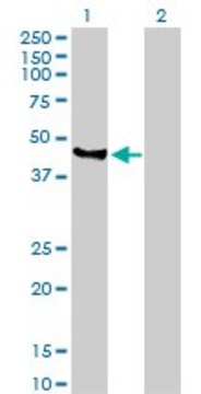 Anti-VIL1 antibody produced in rabbit