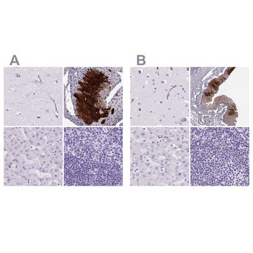 Anti-KRT12 antibody produced in rabbit