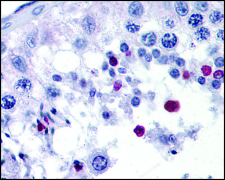 Anti-SPANXC (AB2) antibody produced in