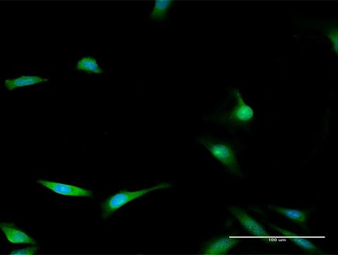 Anti-ENOPH1 antibody produced in rabbit
