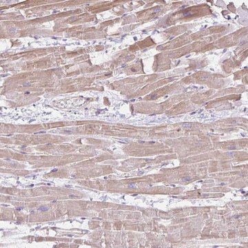 Anti-CDRT15 antibody produced in rabbit