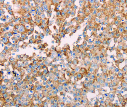 Anti-GNA11 antibody produced in rabbit