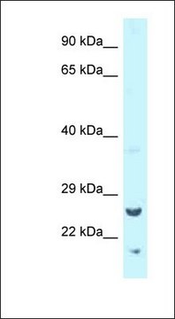 Anti-TK1 antibody produced in rabbit