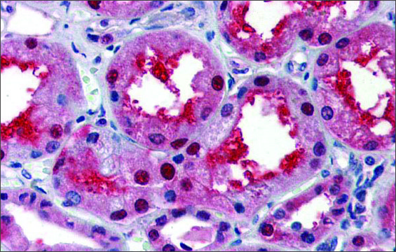 Anti-LASS2 (ab2) antibody produced in