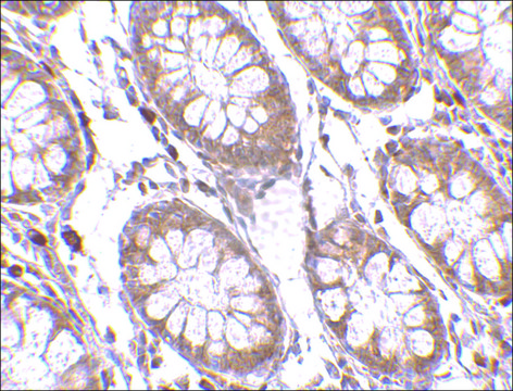 Anti-PTK7 antibody produced in rabbit