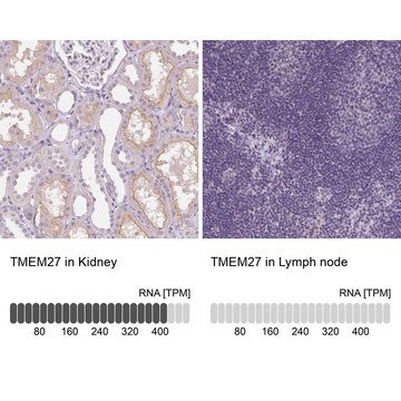 Anti-TMEM27 antibody produced in rabbit