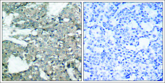 Anti-MAP2K1 (Ab-221) antibody produced in