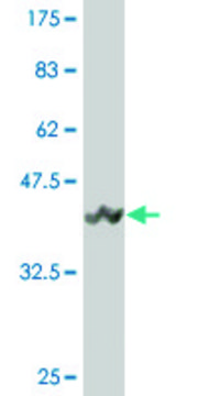 Monoclonal Anti-UBE2B antibody produced in