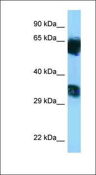 Anti-MGAT5B antibody produced in rabbit