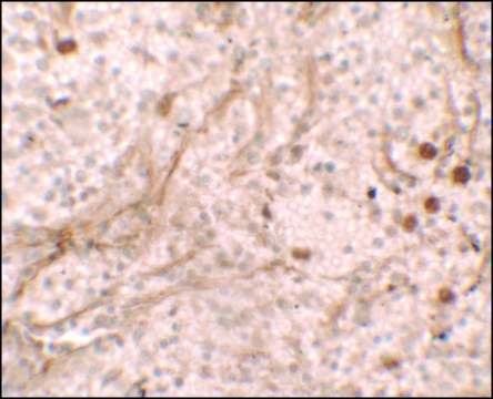 Anti-PIBF1 antibody produced in rabbit